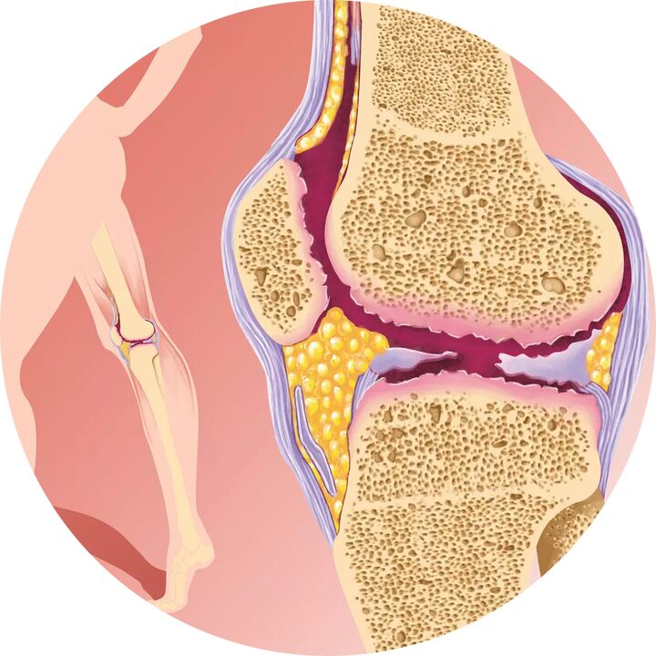 Hondroten - atbalsta locītavu kustīgumu