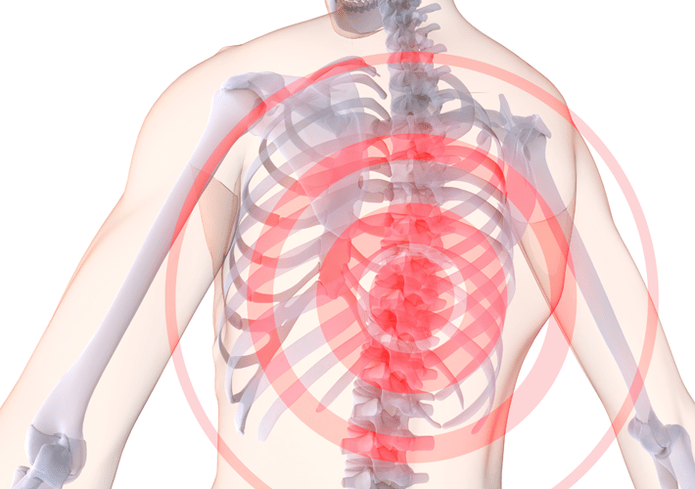 Krūšu mugurkaula osteohondroze